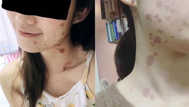 黄凯仪自曝过年下厨发生意外，严重到二级烧伤。(图/ 摘自黄凯仪IG)