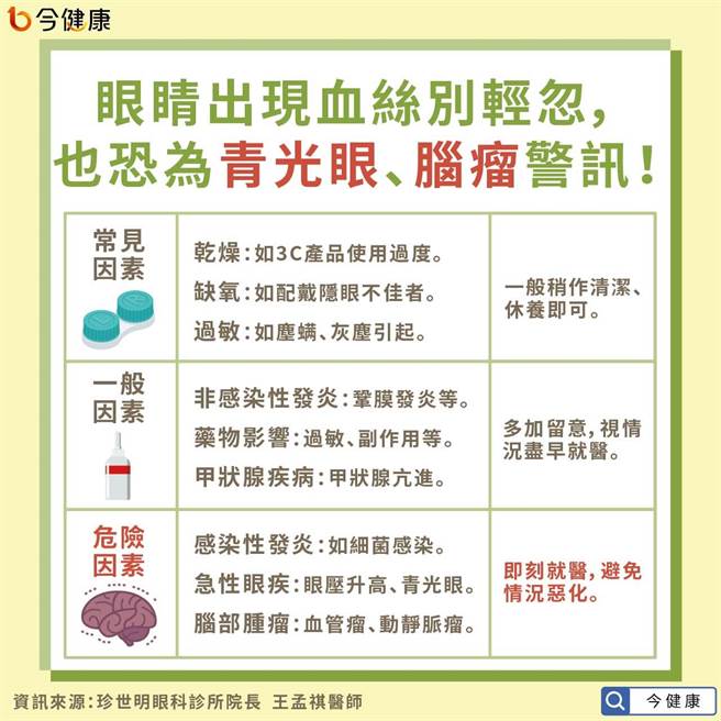 眼睛出現血絲別輕忽，也恐為青光眼、腦瘤警訊！(圖/今健康提供)