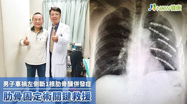 賴重佑部長表示，肋骨固定術後順利 且無發生預期可能會發生的感染問題。（圖／NOW健康提供）