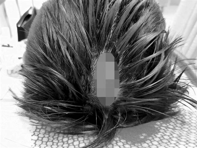 21歲店員被打到頭頂縫12針，照片曝光相當令人不捨。（截自《爆料公社）》