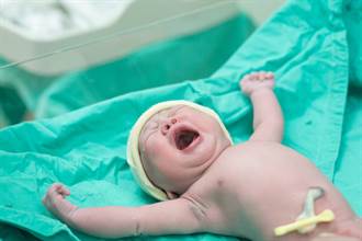 產婦打麻醉後睡著 醒來後驚見寶寶「自己出生」