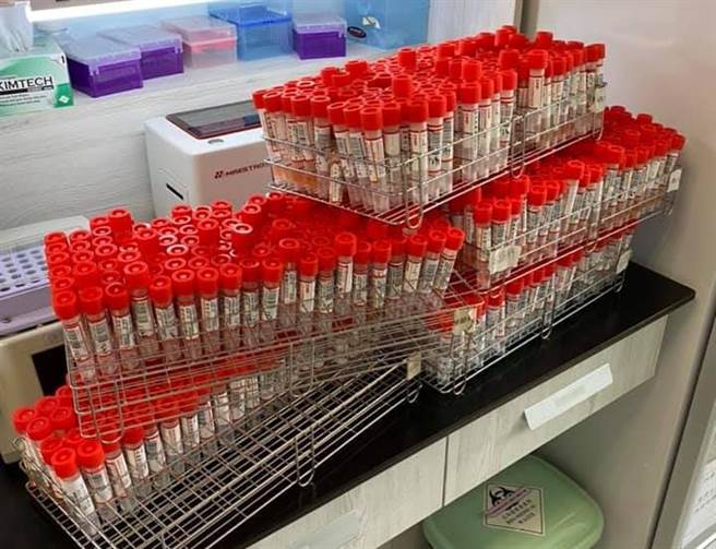 高医医技系老师分享检验人员收到的爆量检体照，替检疫人员没日没夜工作还遭人质疑「盖牌」叫屈。（图／脸书_Wanchi Tsai）