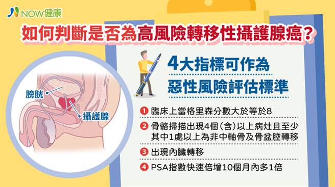 如何判断是否为高风险转移性摄护腺癌？4大指标可作为恶性风险评估标准。（图／NOW健康提供）