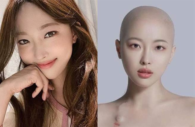 30岁最美抗癌网红黎明病逝。(图／翻摄自韩网)