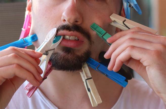 来自英国的盖瑞因为罹患俗称的「松皮症」，皮肤厚度只有一般人的一半，却跟橡皮一样有高度的延展性。（示意图／达志影像）