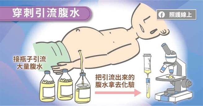 那为什么会跑出腹水呢？