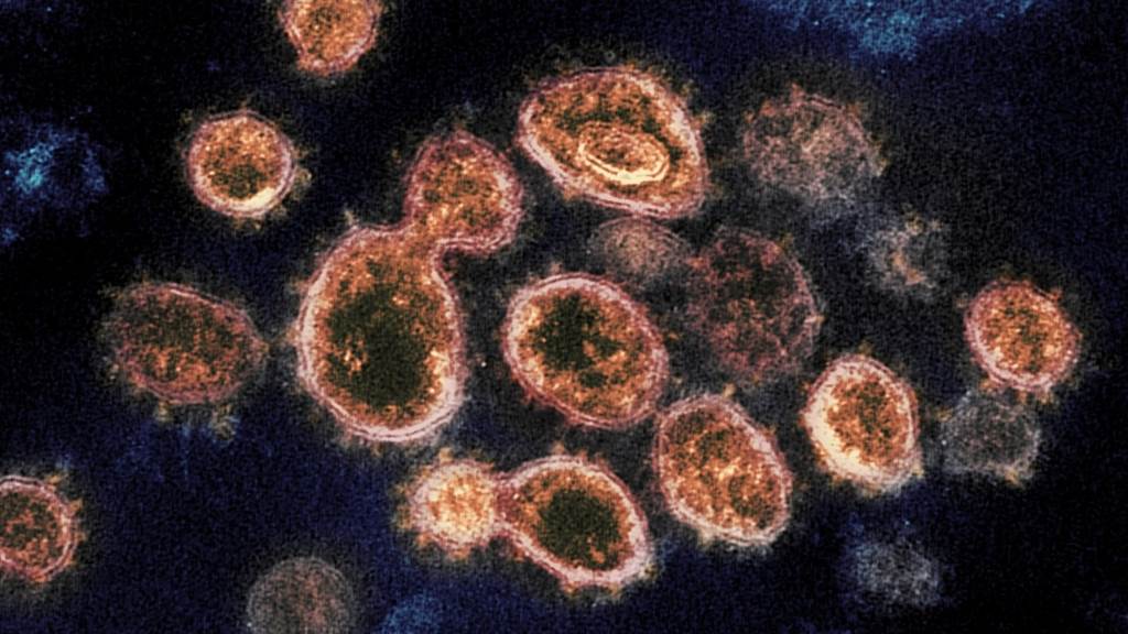 新冠病毒的第5個變體-Delta印度變種病毒，感染力與抗疫苗力都很強，圖為電子顯微鏡下的新冠病毒。(圖/美聯社)