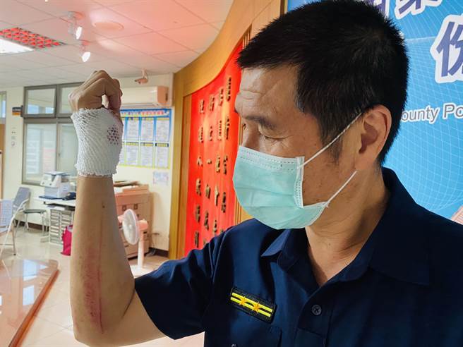 头份派出所长林焕然在缉捕过程中右手掌受伤缝4针。(戴志扬翻摄)

