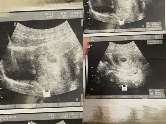 网友在男友房间找到1本男友与前女友的生活小本子，里头纪录着男友与前女友的感情点滴，不过某1页内页竟夹着2张「胎儿超音波照」。（图／翻摄自Dcard）