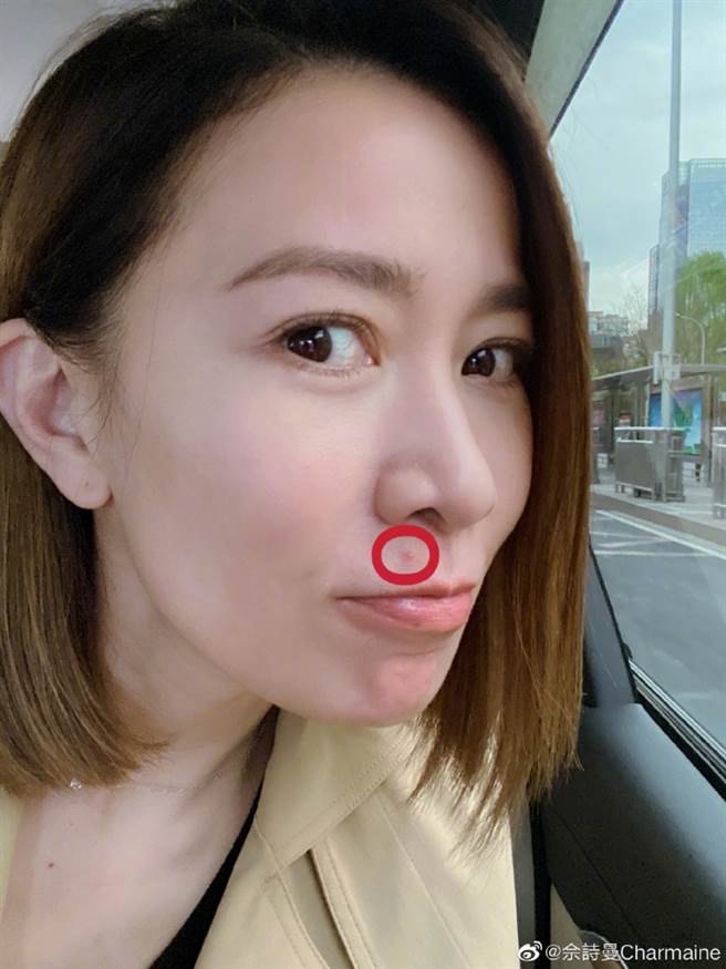 畲诗曼晒美照，幽默自嘲46岁了还长痘痘。（图／取材自畲诗曼微博）
