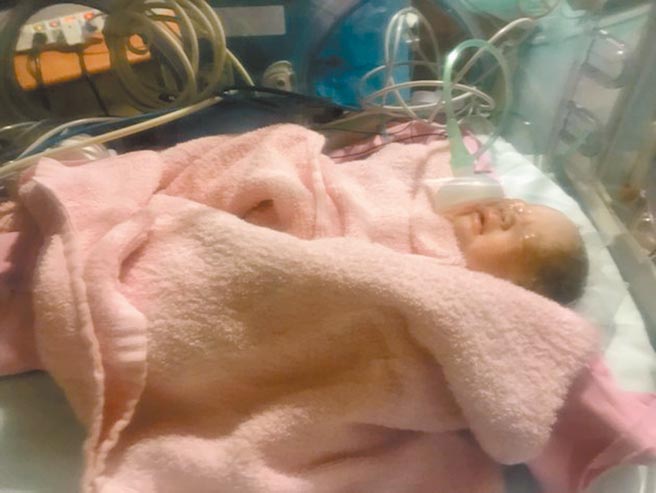 在動員產科、新生兒科、麻醉科、內科、感染科及重症醫療團隊之下，王小姐接受剖腹產，順利產下女寶寶。（台大醫院提供／林周義台北傳真）