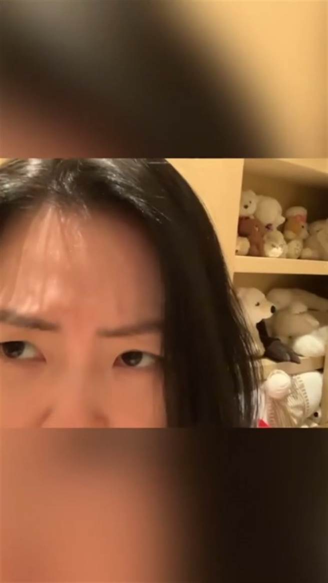 小S说自己长痘痘又冒白头髮。（图／IG@小S）