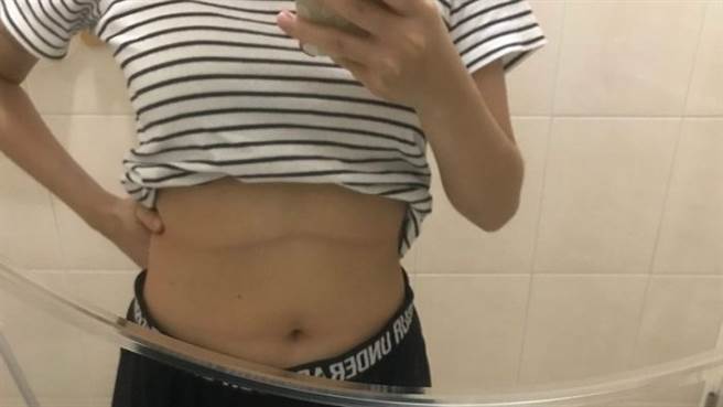 女大生对于肚皮上的横线感到不解，便上网求助网友，没想到钓出大批网友解答是「驼背线」。（图／翻摄自Dcard）