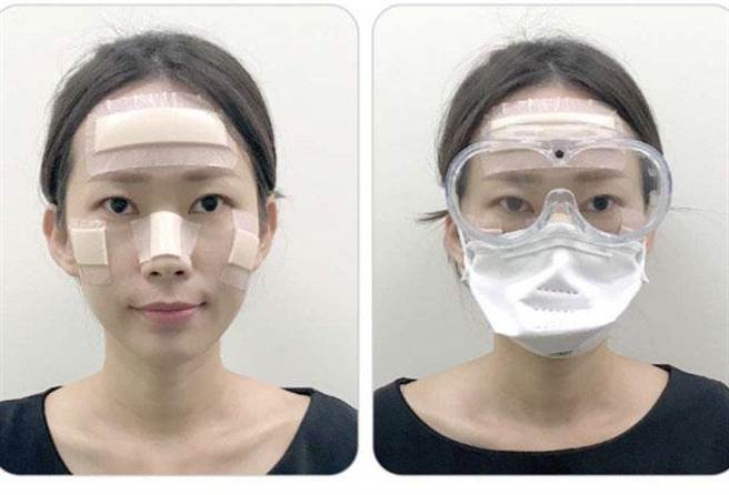 于额头、颧骨、鼻梁等骨突处黏贴泡棉，再戴上护目镜与口罩。(奇美医学中心提供／曹婷婷台南传真)