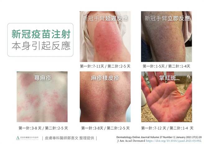 (图/资料来源 郑惠文医师、常春月刊提供)