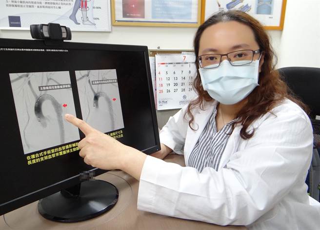奇美医学中心心臟血管外科主治医师吴依璇。(奇美医学中心提供／曹婷婷台南传真)