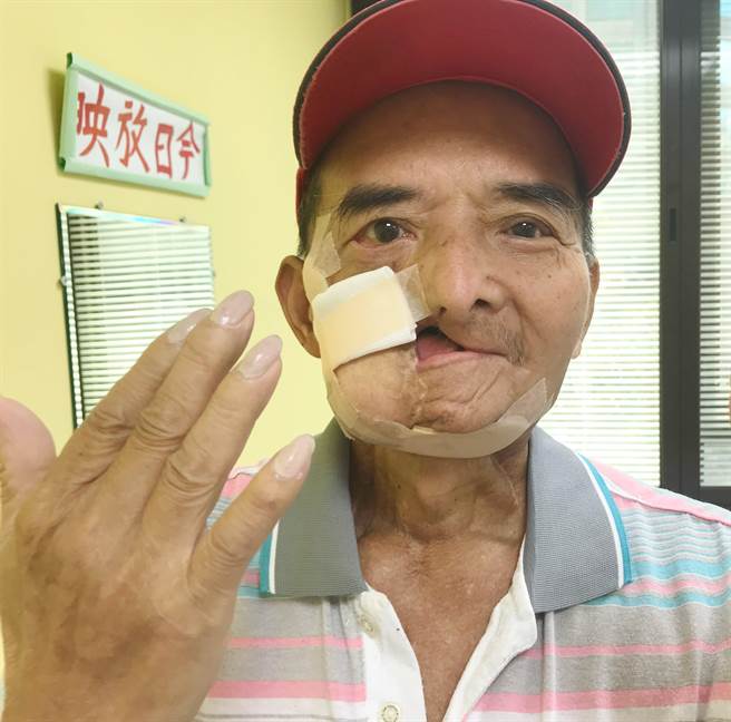 为帮助口腔癌病友有个基本尊严的生活，阳光基金会现正筹募「口腔癌病友服务计画」经费。（阳光基金会提供／林良齐台北传真）