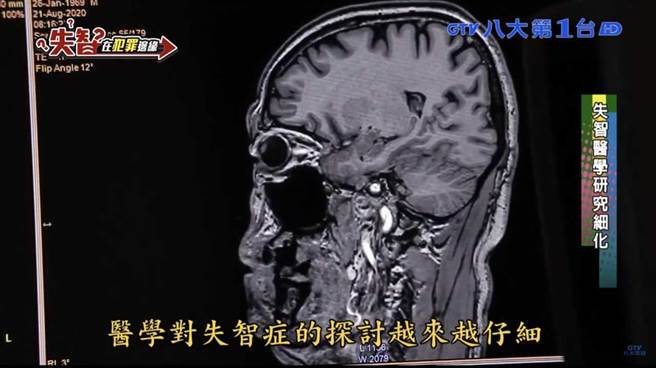 「失智在犯罪边缘」专题获银响力新闻奖。（八大提供）