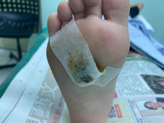 日前有民眾到台東市區空地散步，造成家中幼兒腳受傷。（民眾提供／蔡旻妤台東傳真）