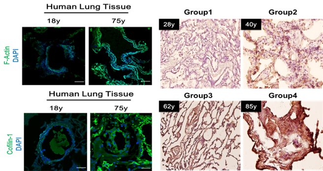 人类肺部细胞切片，可以发现年纪越大，细胞衰老以及型态也变得更大。(图/阳明交大提供)