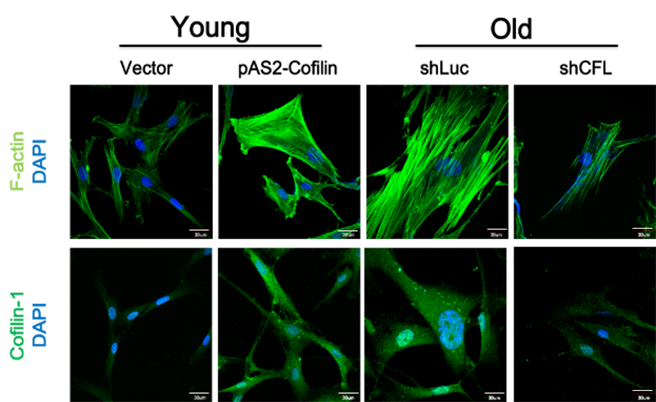 老年与年轻细胞，肌动蛋白萤光染色后的比较。(图/国立阳明交大提供)