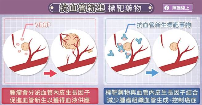 (图/照护线上提供)