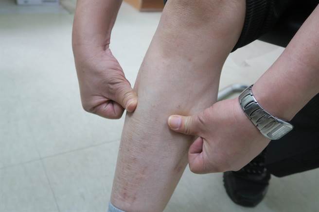 也可按摩两小腿的胃经与脾经路线，胫骨的外侧是胃经路线，内侧是脾经路线，双手的大拇指从膝盖下方开始，沿着胫骨两侧从上往下按摩。（吴建辉摄）