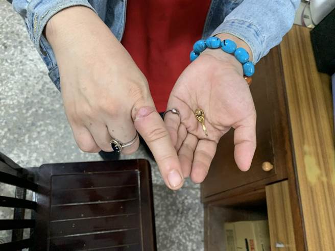 官田消防分队以斜口钳破坏戒指，建议妇人就医检查治疗。（读者提供／刘秀芬台南报导）