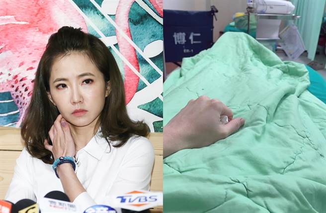 谢忻透露颱风夜紧急送急诊。（图／中时资料照片；翻摄自谢忻脸书）