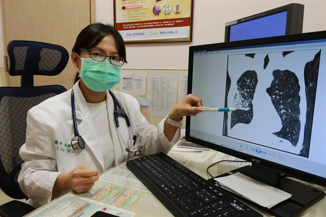 亚大医院胸腔内科主治医师陈铃宜，在X光影向上指出慢性阻塞性肺病位置。（林欣仪摄）