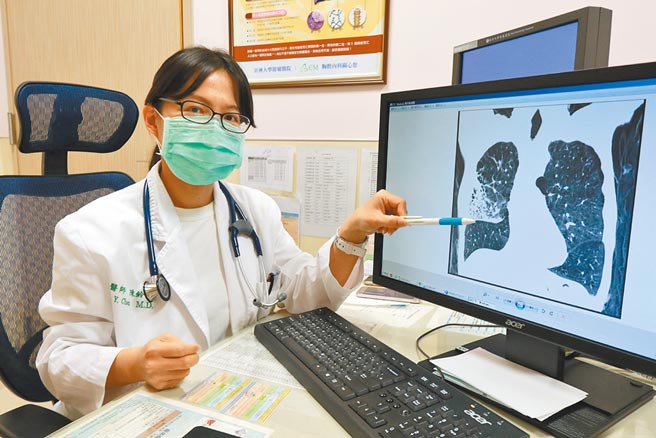 亚大医院胸腔内科主治医师陈铃宜，在X光影像上指出慢性阻塞性肺病的位置。（林欣仪摄）