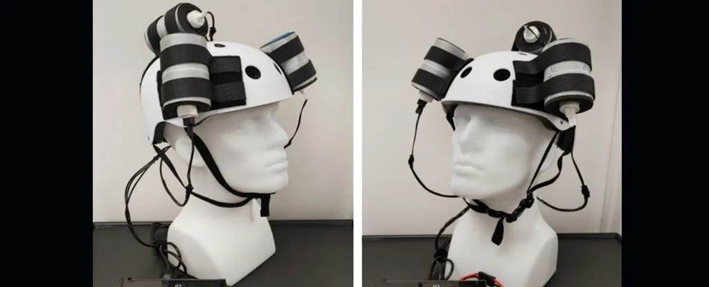 以3具旋转式磁场仪做成的治疗脑癌头盔，竟成功缩小了最恶性的脑肿瘤。图/Houston Methodist Hospital(photo:ChinaTimes)