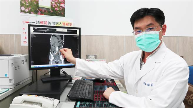 徐玮呈表示，陈女士不小心误食固定爌肉的牙籤，导致腹痛及发烧，赶紧急安排「腹腔镜微创手术」即刻救援，取出牙籤。（台中医院提供／张妍溱台中传真）