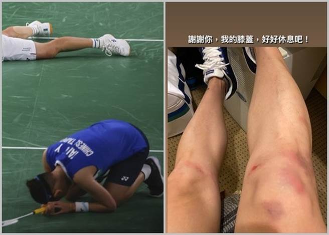戴資穎的雙腿在這次奧運受了很多傷。（翻攝自IG）
