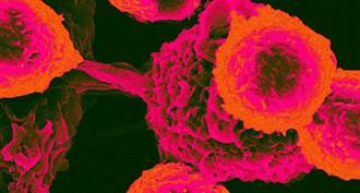 科學家發現了一種與所有癌症有關的蛋白質，似乎可以通過開關它來治癒癌細胞。