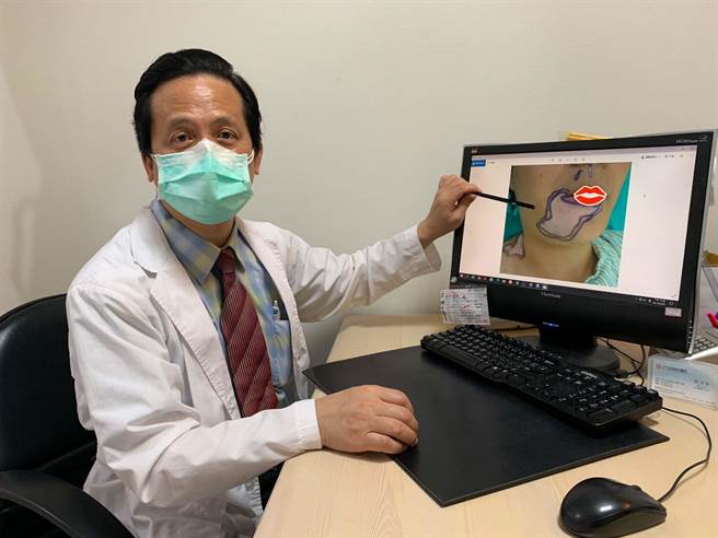 光田綜合醫院整形外科主任吳文宏表示，白斑症佔台灣人口２％，且較年輕化，可透過治療改善。（光田醫院提供／王文吉台中傳真）