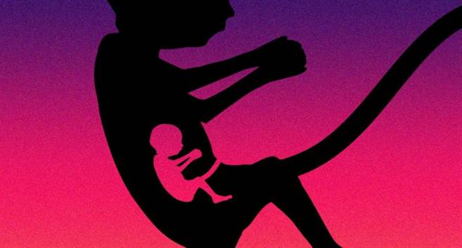 以色列一名女嬰胃中發現未發育完全的胚胎！醫生表示：「罕見胎中胎案例。」（圖／明日科學）