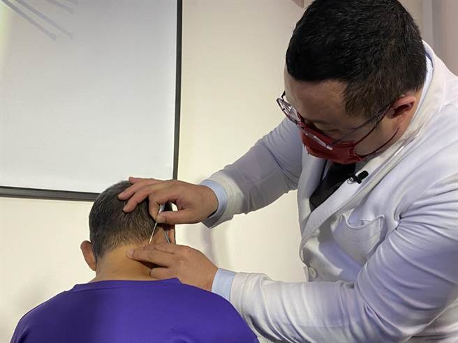 中国医药大学附设医院中医部由中医伤科主任黄敬轩（右）指出浮针虽然源自于针灸，但是一般针灸会垂直皮肤表面刺入穴位，浮针是将针留置在皮下疏松结缔组织层内。（冯惠宜摄）