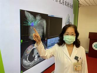 早期乳癌患者放射治療新趨勢 療程5周減剩5天