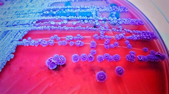 美国本土首次出现只有热带气候地区才会有的类鼻疽病（melioidosis），目前已有4人感染，当中2人死亡，感染源仍不明。（示意图／shutterstock）