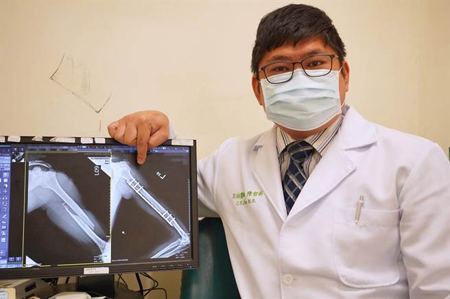 骨科医师陈哲裕表示微创手术让外伤与骨折治疗可获得更好效果。（联新国际医院提供／吕筱蝉桃园传真）