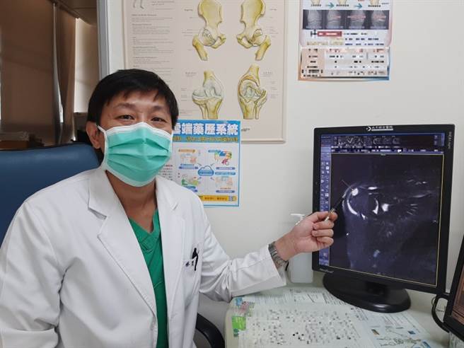 大千综合医院骨科医师蔡旻虔表示，一名患者因为肩膀酸痛无法入睡，就医求诊才发现，原来旋转肌腱已破裂。(图/大千综合医院提供)