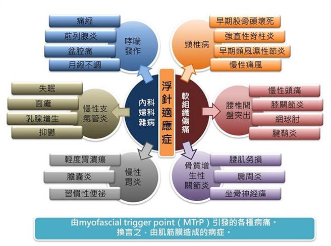 浮针适应症。(图片来源/取自黄敬轩医师记者会简报)