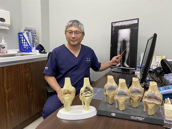 长安医院骨科主任医师杨志鸿说，膝关节经诊断后虽为退化性关节炎第4期至仍可以手术治疗。（长安医院提供／张妍溱台中传真）