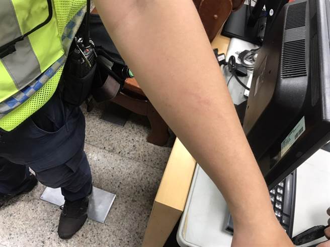 員警阻止邱男遭肘擊跟拉扯而掛彩。（警方提供／曹婷婷台南傳真）