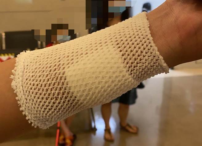 所幸張稟新救醫包紮後，僅有受到皮肉傷無大礙，目前返家休息中，而員林警分局長謝錫釗得知後，已前往探視張稟新，並慰勉張員，肯定他英勇制伏嫌犯，打擊犯罪。（民眾提供／吳建輝彰化傳真）