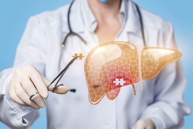 肝纖維化卻未追蹤治療，發展成肝癌的風險遽增。(示意圖/Shutterstock)