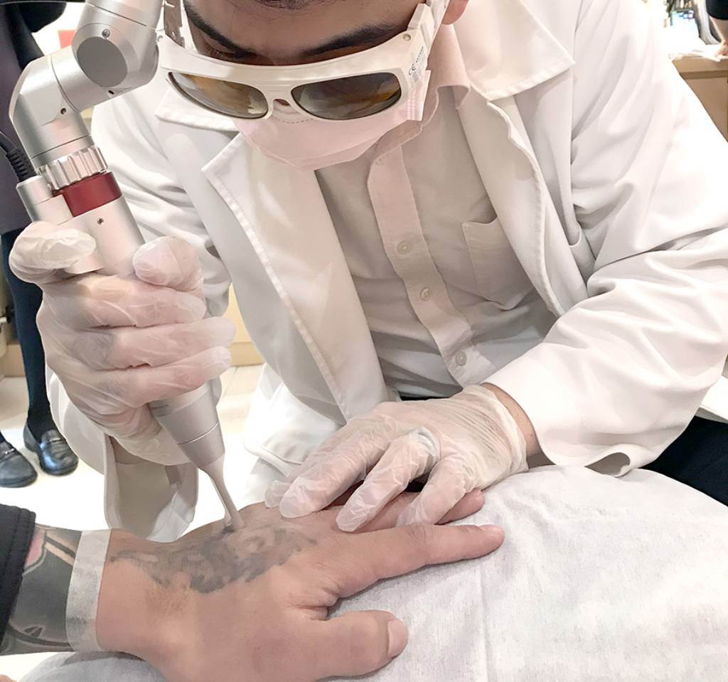 醫美雷射不只淨膚 還能除刺青抹去身上印記。(示意圖/Shutterstock)