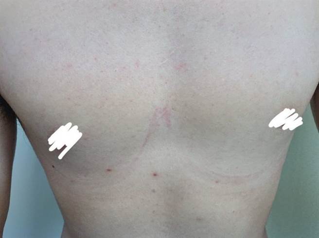 女网友说，最后男友的胸部也被胸罩勒出痕迹，男友回到家中还拿出衣物狂塞进内衣里，笑说「这样才对嘛」。（翻摄自Dcard）