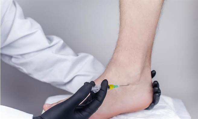 美豔女星腳傷卻暴肥10公斤 醫：類固醇用得好是仙丹 用不好是毒藥。(示意圖/Shutterstock)